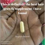 This is definitely the best hair growth supplement I have found